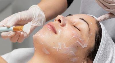 Fruitzuurpeeling in Den Haag: huidverbetering met aandacht en precisie