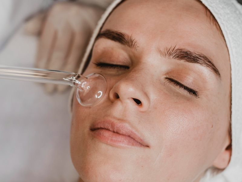 Fruitzuurpeeling in Rotterdam: huidverbetering in een stad die nooit stilstaat