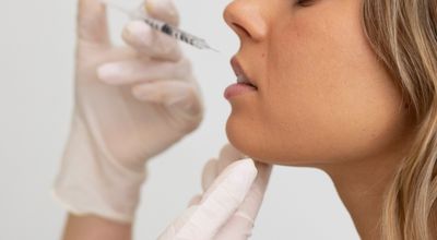 Liplift in Utrecht: een verfijnde ingreep voor een frisse uitstraling