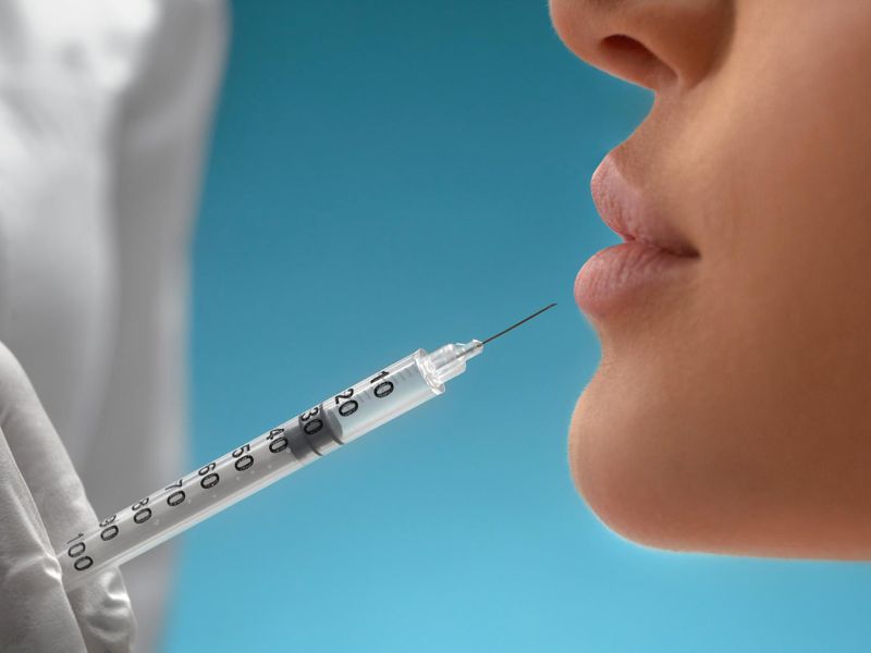 Minder zichtbare fronslijnen? Dit kun je verwachten van botox in Arnhem