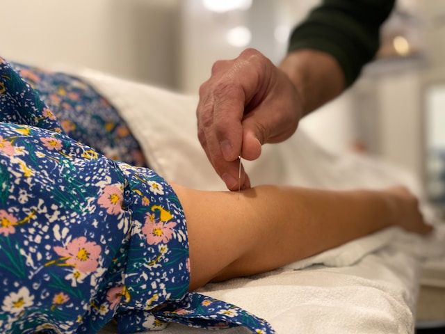 Acupunctuur proberen? Zo bepaal je of een behandeling bij je past