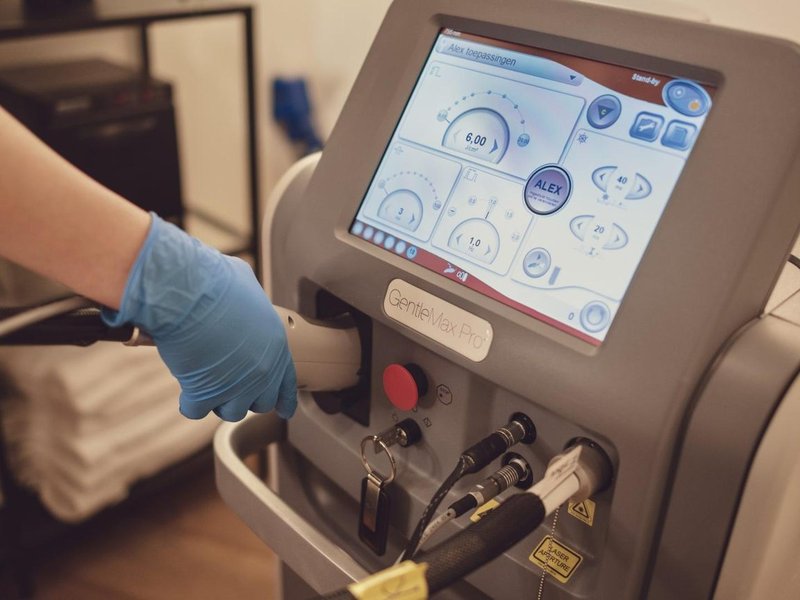 De voordelen van laserontharing